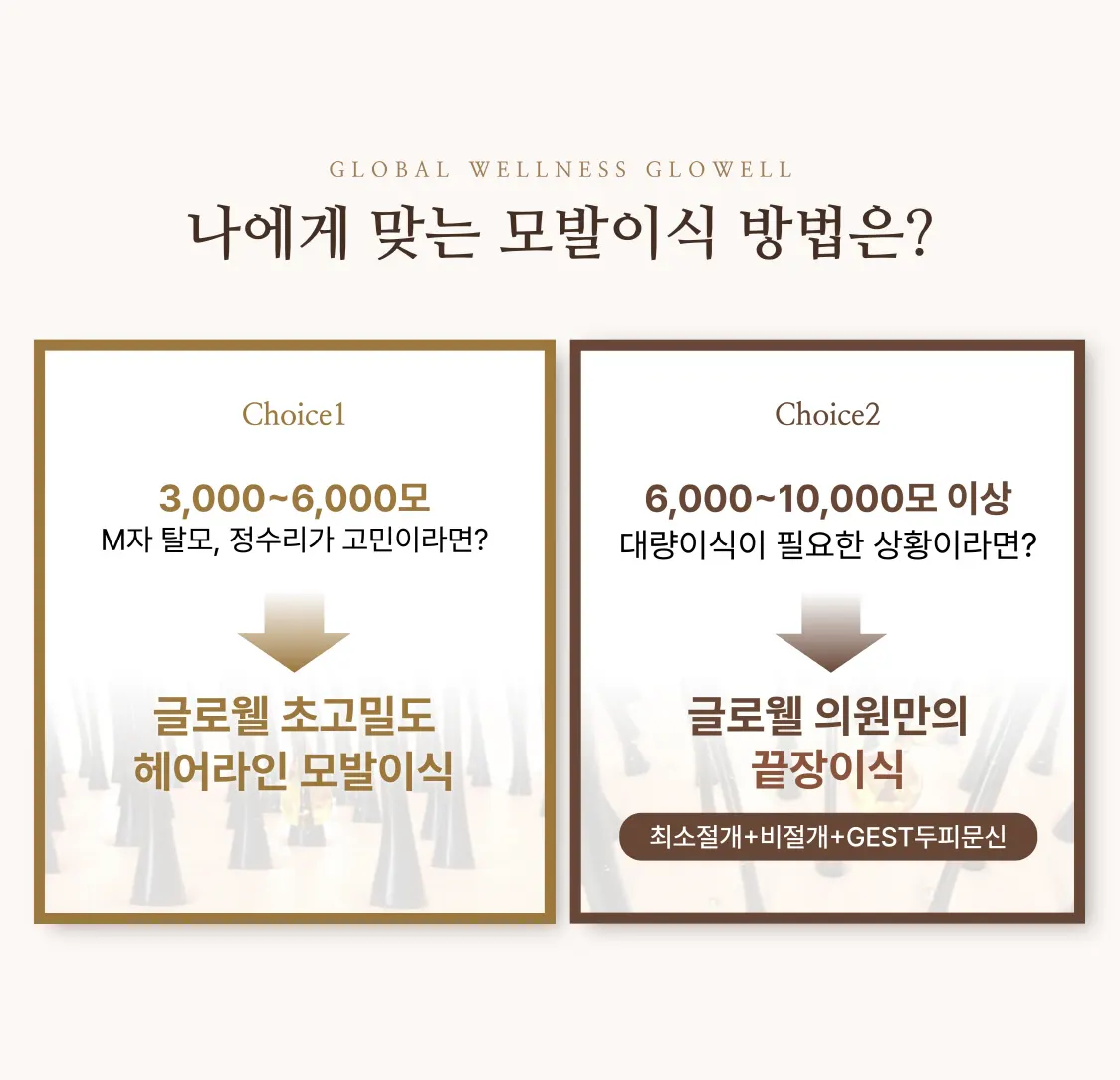 나에게 맞는 모발이식 방법