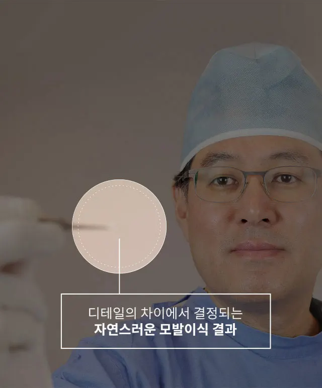 디테일의 차이에서 결정되는 자연스러운 모발이식 결과